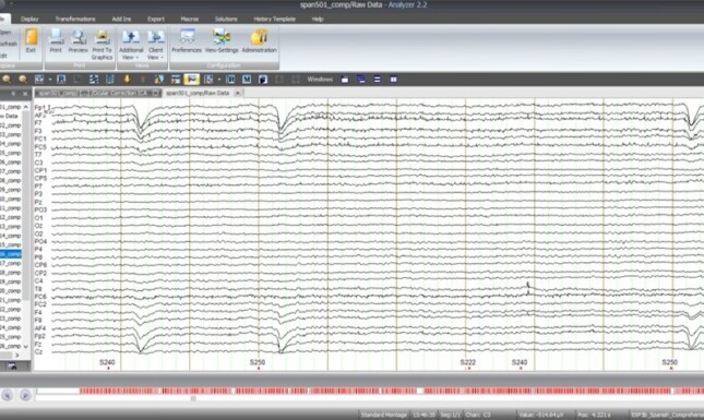 EEG 3